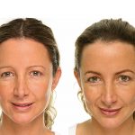 Permanent-Make-up Korrektur